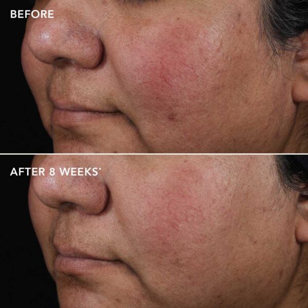 AGELESS+ ретиноловый серум 0,75% - Image 2